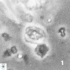 Isocrystallithus partitum 7618