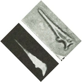 Orthorhabdus serratus 27657
