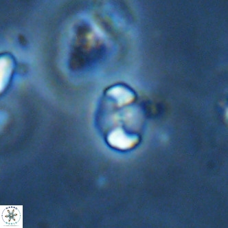 Octolithus multiplus VR 01854
