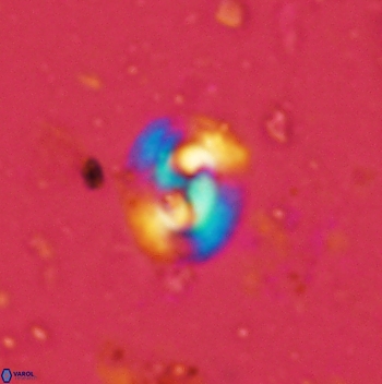 Obturolithus antarcticus 2450