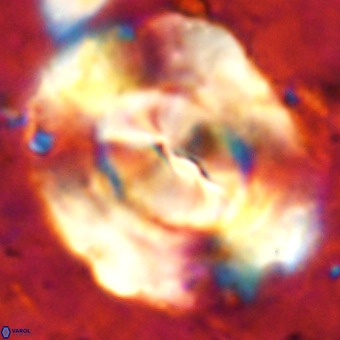 Obturolithus burnsii VR 00023