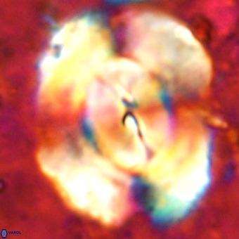 Obturolithus burnsii VR 00022