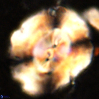 Obturolithus burnsii VR 00027