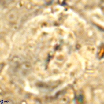 Obturolithus burnsii VR 00028