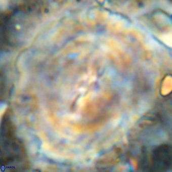 Obturolithus burnsii VR 00030