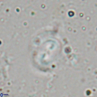 Obturolithus scissurus 22798