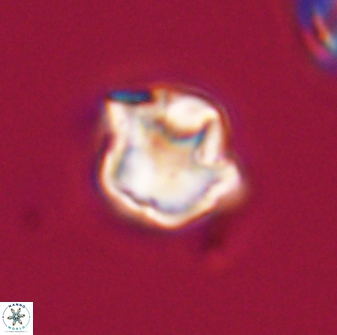 Olladiscoaster vestigium 31549