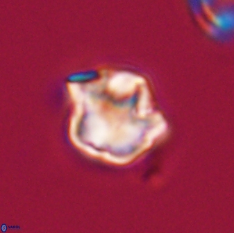 Olladiscoaster vestigium 31551