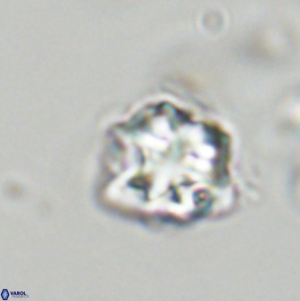 Olladiscoaster vestigium 31555