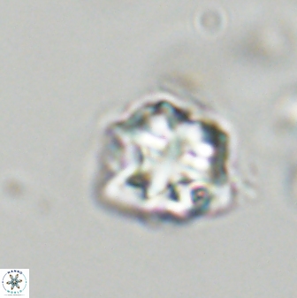 Olladiscoaster vestigium 31555