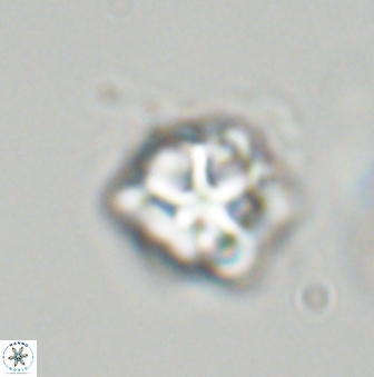Olladiscoaster vestigium 31559