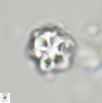 Olladiscoaster vestigium 31565