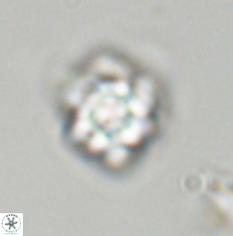 Olladiscoaster vestigium 31574
