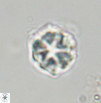 Olladiscoaster vestigium 31576