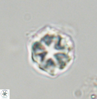 Olladiscoaster vestigium 31577