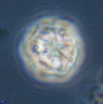 Olladiscoaster vestigium 31582