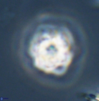 Olladiscoaster vestigium 31583