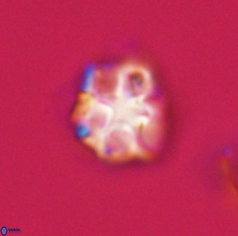 Olladiscoaster vestigium 31593