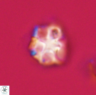 Olladiscoaster vestigium 31593