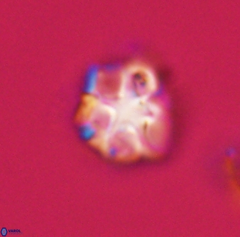 Olladiscoaster vestigium 31596