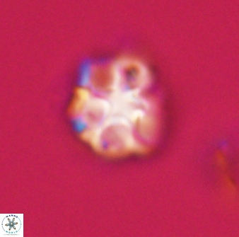 Olladiscoaster vestigium 31597