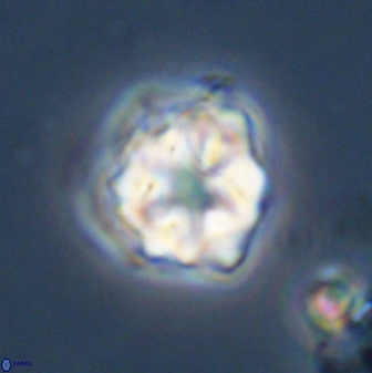 Olladiscoaster vestigium 31602