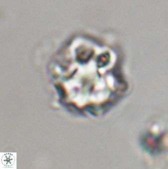 Olladiscoaster vestigium 31607