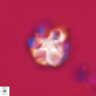 Olladiscoaster vestigium 31613