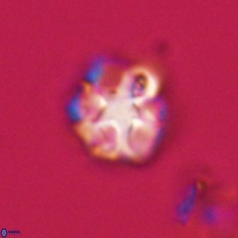 Olladiscoaster vestigium 31615