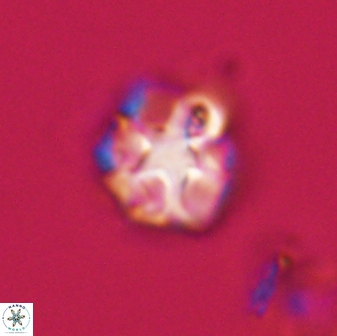 Olladiscoaster vestigium 31615
