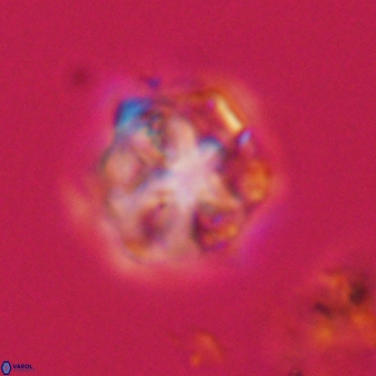 Olladiscoaster vestigium 31622