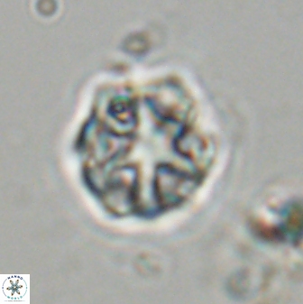 Olladiscoaster vestigium 31626