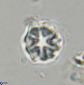 Olladiscoaster vestigium 31629