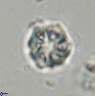 Olladiscoaster vestigium 31631