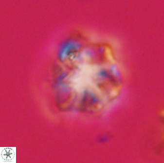 Olladiscoaster vestigium 31636
