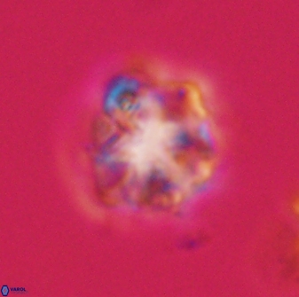 Olladiscoaster vestigium 31639