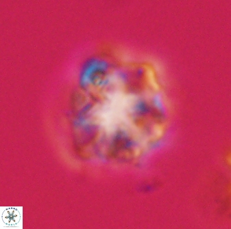 Olladiscoaster vestigium 31639
