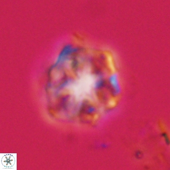 Olladiscoaster vestigium 31640