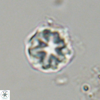 Olladiscoaster vestigium 31643