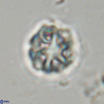 Olladiscoaster vestigium 31644