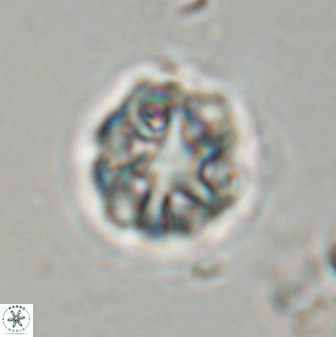 Olladiscoaster vestigium 31644