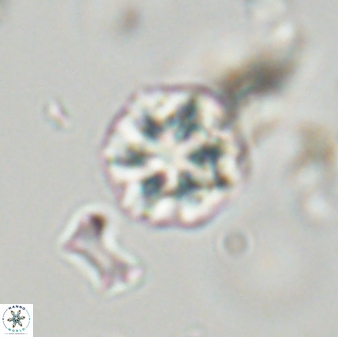 Olladiscoaster zucciae 32026