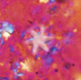 Olladiscoaster asterilithos 29576