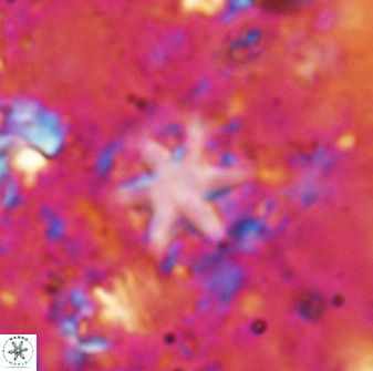 Olladiscoaster asterilithos 29576