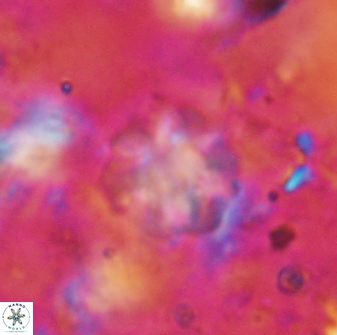Olladiscoaster asterilithos 29577