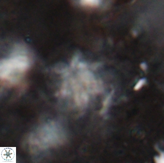 Olladiscoaster asterilithos 29578