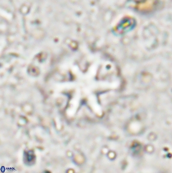 Olladiscoaster asterilithos 29579