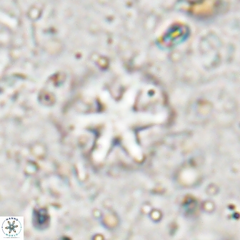 Olladiscoaster asterilithos 29579