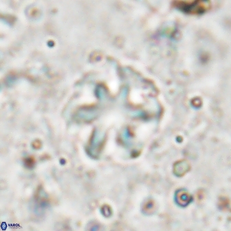 Olladiscoaster asterilithos 29580