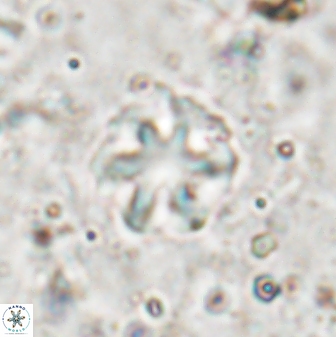 Olladiscoaster asterilithos 29580
